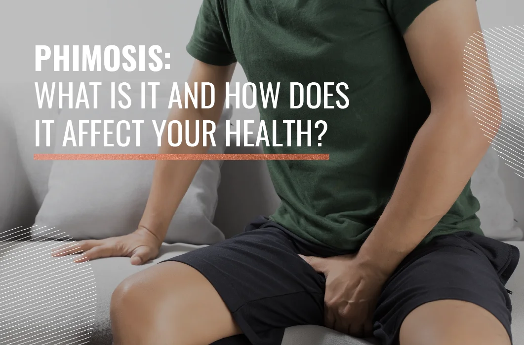 Phimosis: What is it and how does it affect your health?